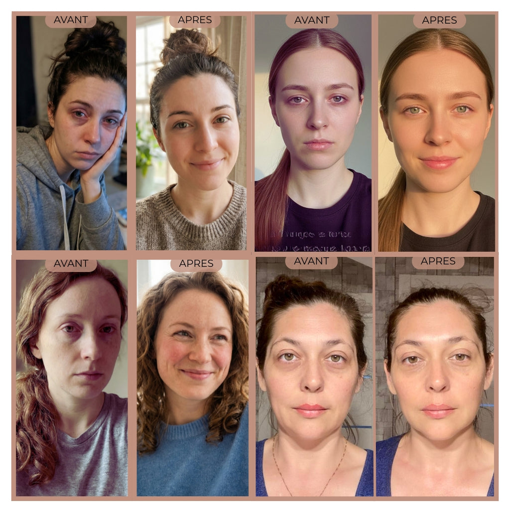 Masque Gel Chaud / Froid